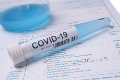 covid highest kentucky number reports cases testing